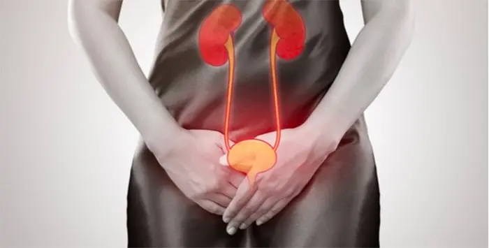 Măng cụt - 10+ tác dụng cần biết, Cách chọn - Bảo quản măng! 6 Măng cụt giúp cải thiện bệnh viêm đường tiết niệu